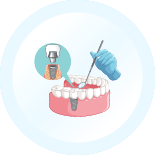 Implantology